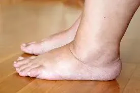 Swelling service image