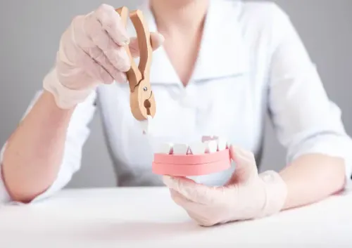 SURGICAL TOOTH AND THIRD MOLAR EXTRACTION service image