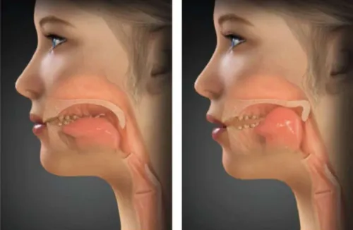 Speech Therapy and Voice Therapy service image