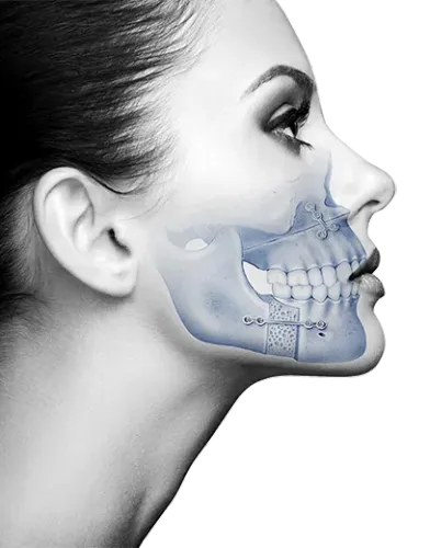 Cosmetic Voice Surgery (Classical Approach) service image