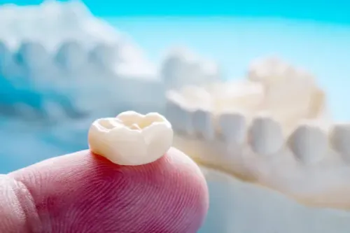 Dental Crowns service image