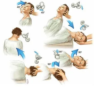 Vertigo Treatment service image