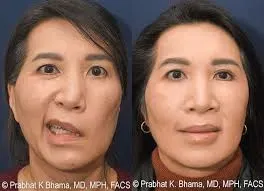 Surgery Of The Facial Nerve service image