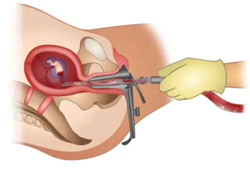 MTP Doctor in Wakad,Hinjewadi,Pune service image