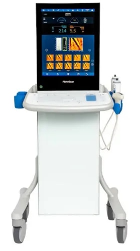Fibroscan  service image