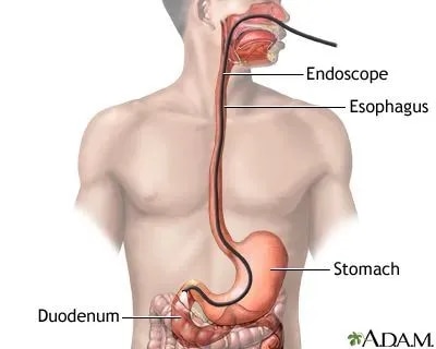 Gastroscopy service image