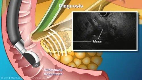 Endoscopic Ultrasound (EUS) service image