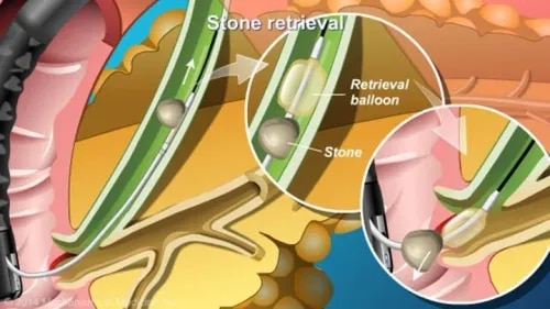 ERCP service image