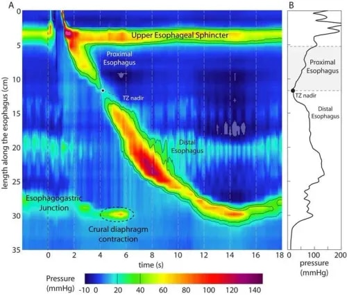 Esophageal Manometry  service image