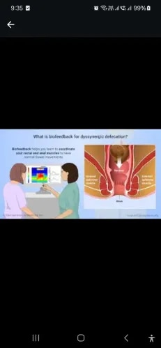 Biofeedback Therapy service image