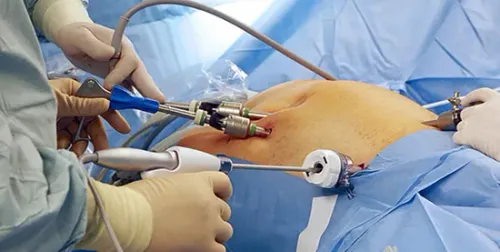 Laparoscopy and Hysteroscopy service image