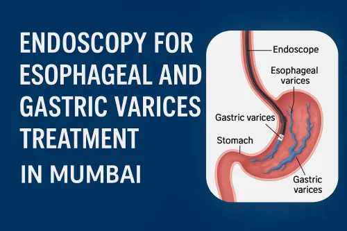 "Endoscopy for Esophageal and Gastric Varices Treatment in Mumbai,  and India" service image