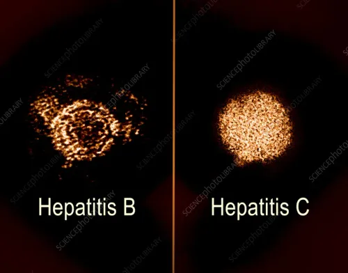 Hepatitis B & C Specialist Clinic — Diagnosis, Treatment & Long-term Care Hepatitis Management Clinic for Liver Health service image