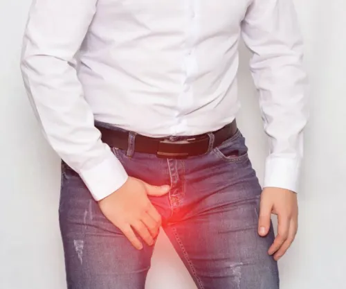 Varicocele Treatment service image