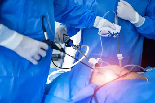 Laparoscopic Hernia Surgeries service image
