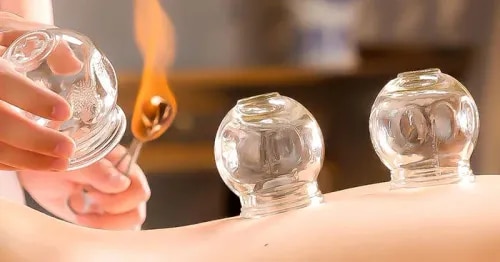 Fire Cupping Therapy  service image
