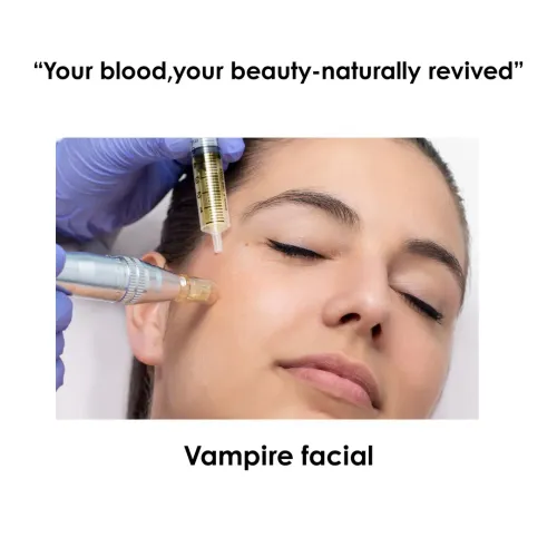 vampire facial service image