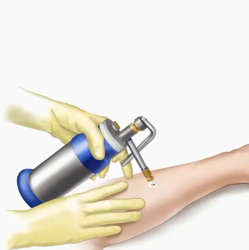 CRYOTHERAPY service image
