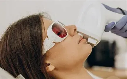 PHOTOFACIAL service image