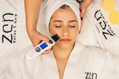 Best Acne Treatment In Coimbatore service image