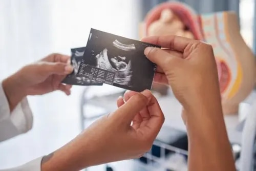 Ultrasonography service image