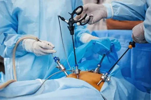 Laparoscopic  and Gastrointestinal  Surgeries service image
