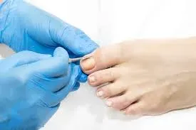 NAIL SURGERY service image