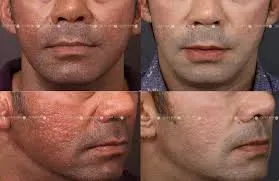 Skin Rejuvenating Treatment service image