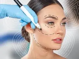 Face Lifting Treatments service image