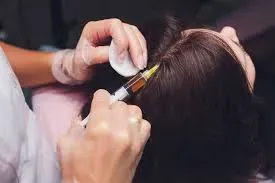 Advance Hair Treatments service image
