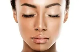Fairness Treatments service image