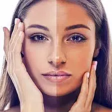 Tan Removal Treatment  service image