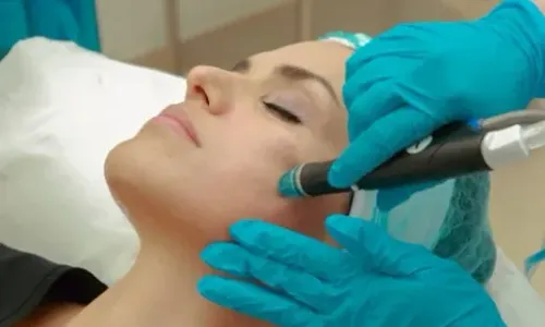 HydraFacial Treatment Coimbatore service image