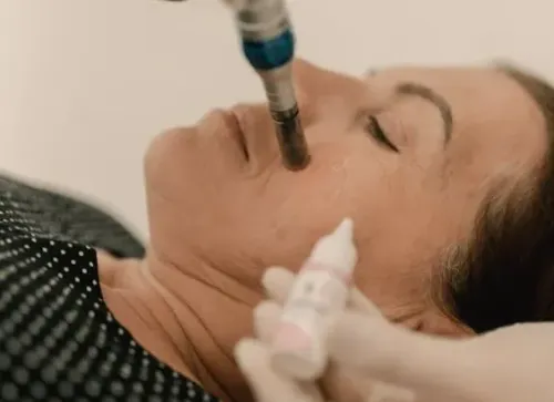 Anti-aging Skin Clinic Coimbatore service image