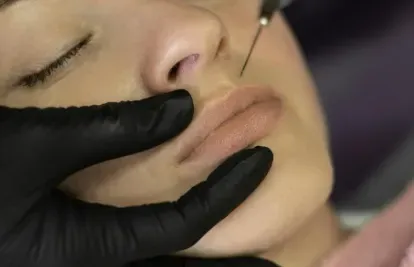 lip pigmentation treatment in Coimbatore service image