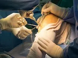 Bone & Joints - Orthopedic  Trauma & Joint Replacement service image