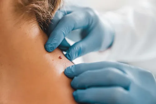 Dermatosurgery service image