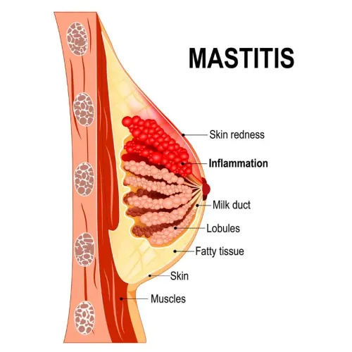 Breast illnesses and Breast surgery service image