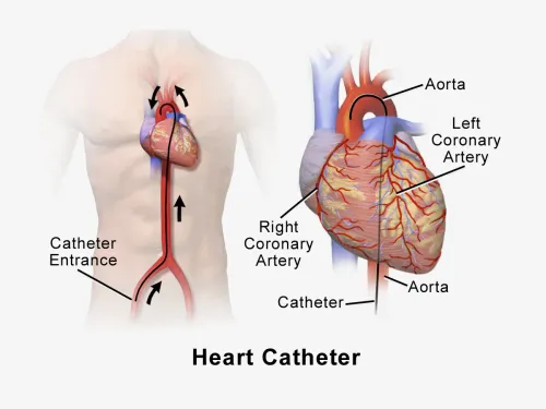 Coronary Angiogram service image
