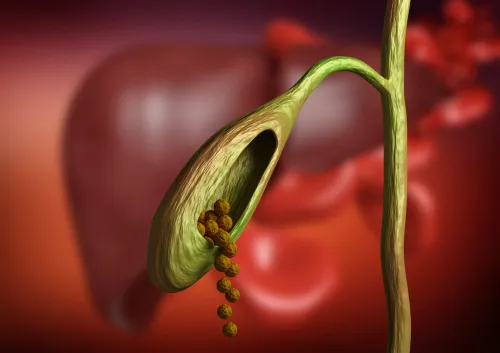 Gallbladder Surgery service image