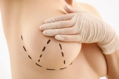 Breast Cancer Surgeries service image