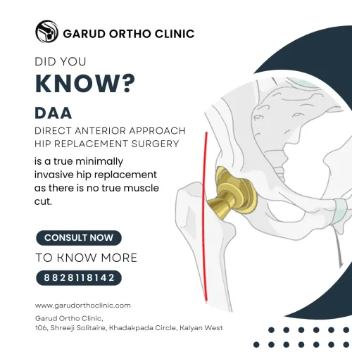 Direct Anterior Approach Hip Replacement Surgery service image