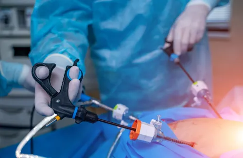 Laparoscopic Cancer Surgeries service image