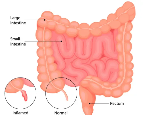 Appendix Surgery service image