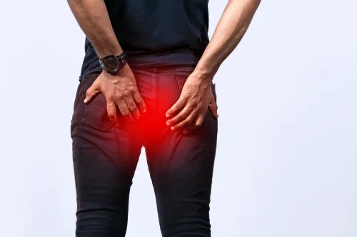 Fissure service image