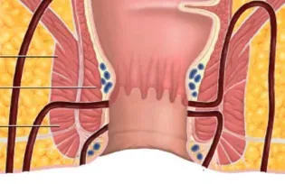 Fistula service image