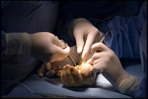 Hand Surgery  product image