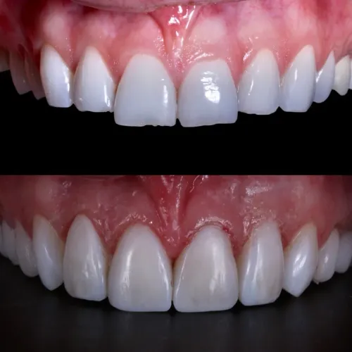 Cosmetic Dentistry-Smile Designing service image
