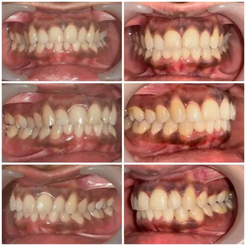 Orthodontic Treatment service image