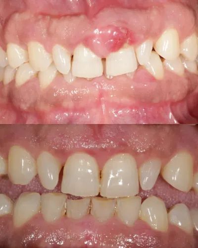 Gum Treatments (Periodontics) service image